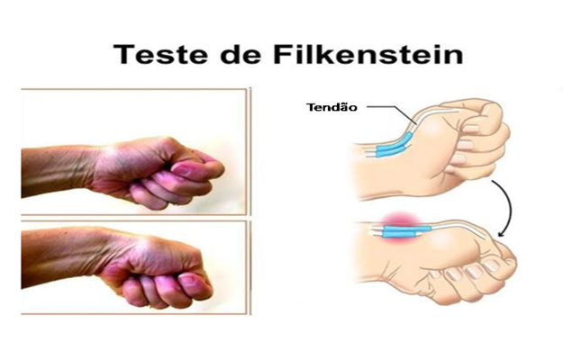 O Movimento Essencial: Entendendo a Articulação do Polegar - inspiração 2