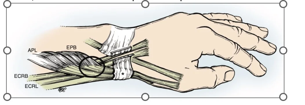 Técnica da Ponte: Melhorando a Coordenação e o Controle - inspiração 1