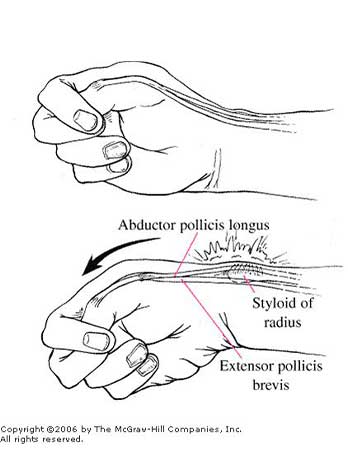 Alongamento de Pinça: Ação Direta para Melhorar a Firmeza - inspiração 1