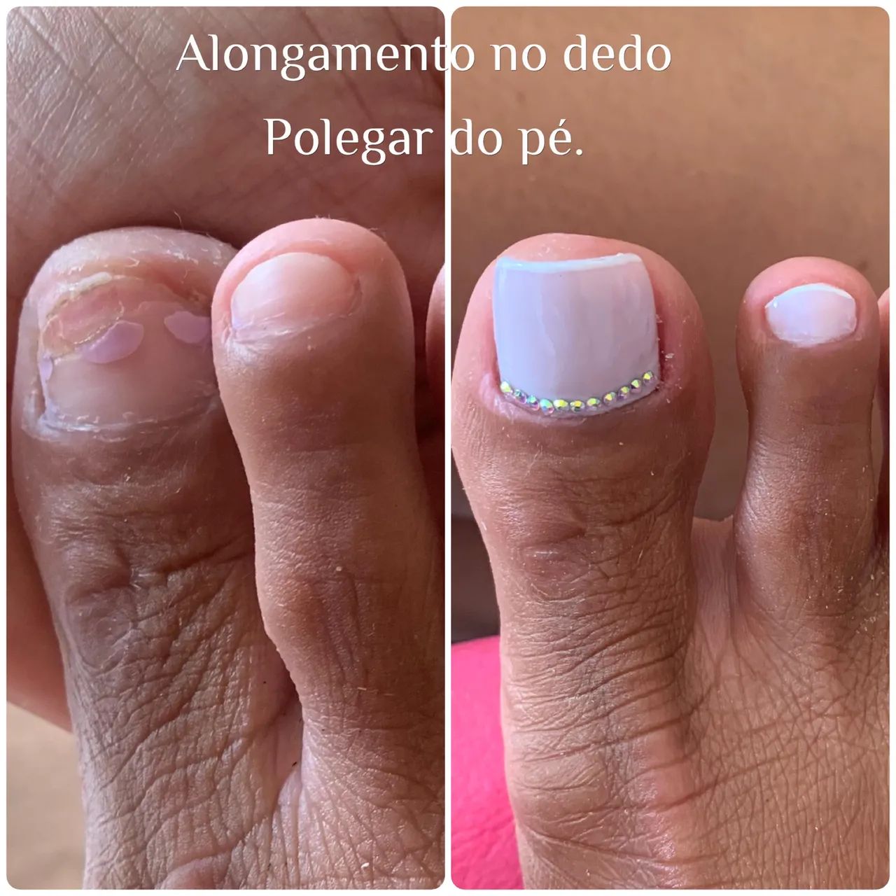 Cuidado extra: Alongamentos para dedos em garra - inspiração 2