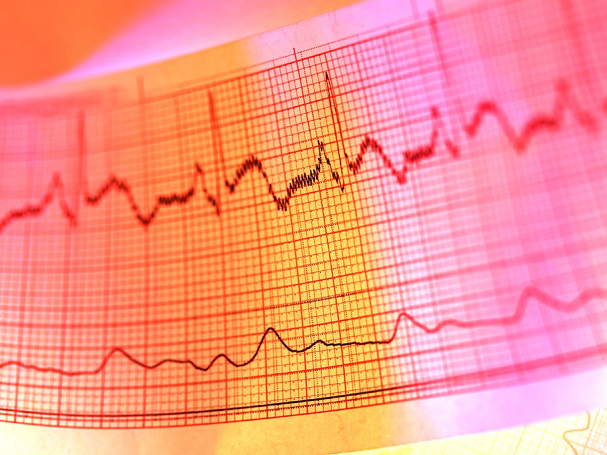 A Frequência Cardíaca e o Envelhecimento: O Que Muda? - inspiração 1