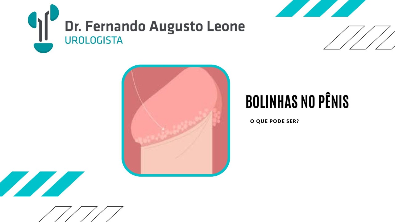 Bolinhas Doloridas no Pênis: A Possibilidade de Inflamação - inspiração 1