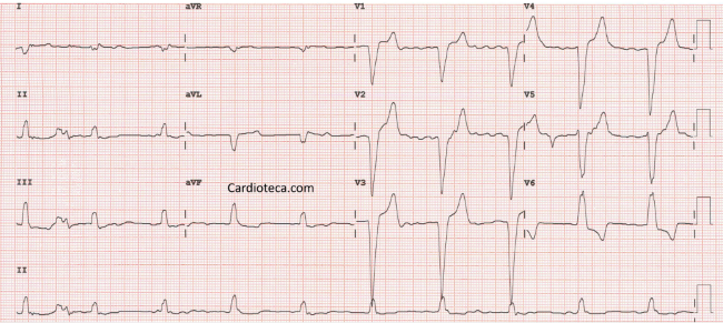 Prevenção e Cuidados Para um Coração Saudável - inspiração 1