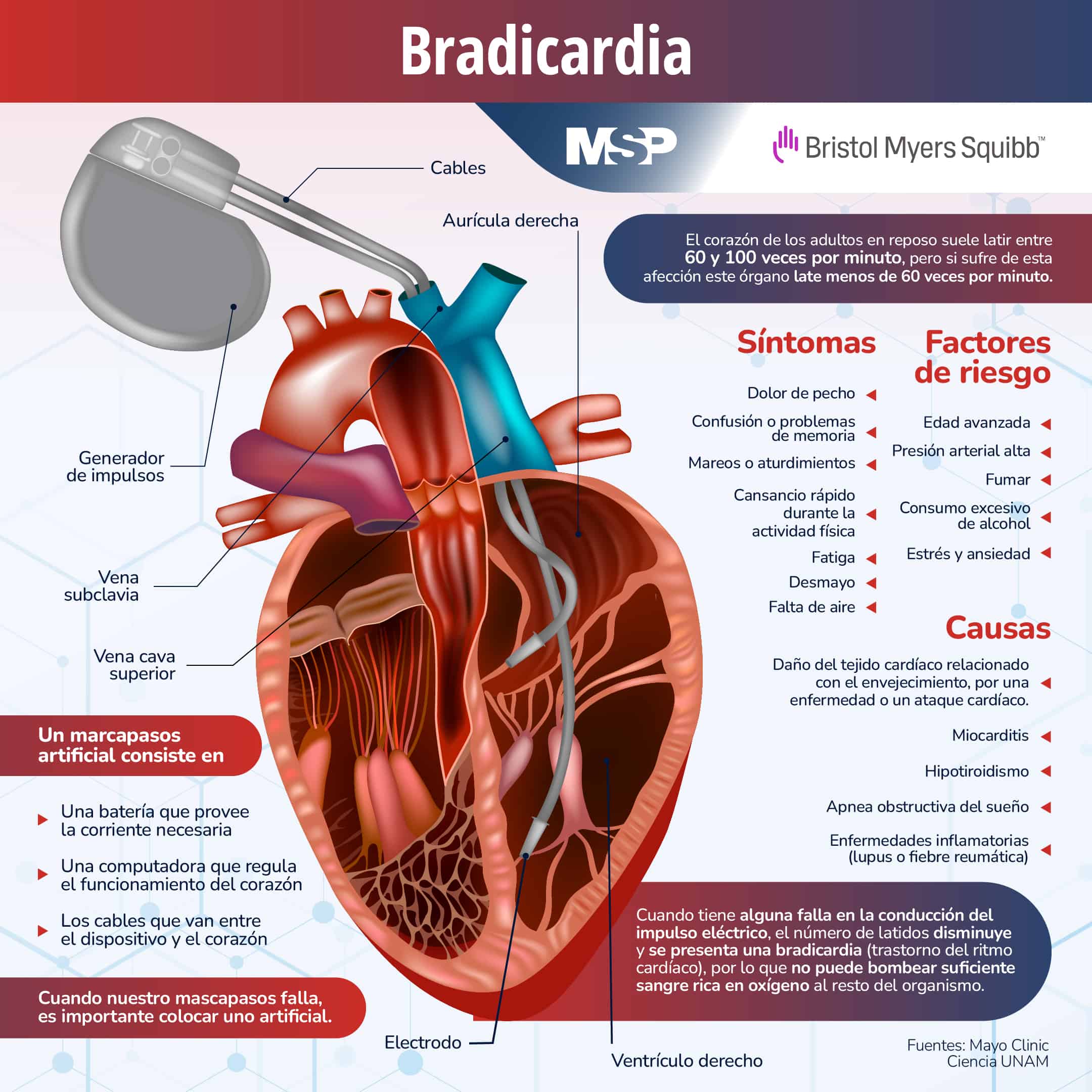 Bradicardia em Mulheres: Algumas Especificidades - inspiração 1