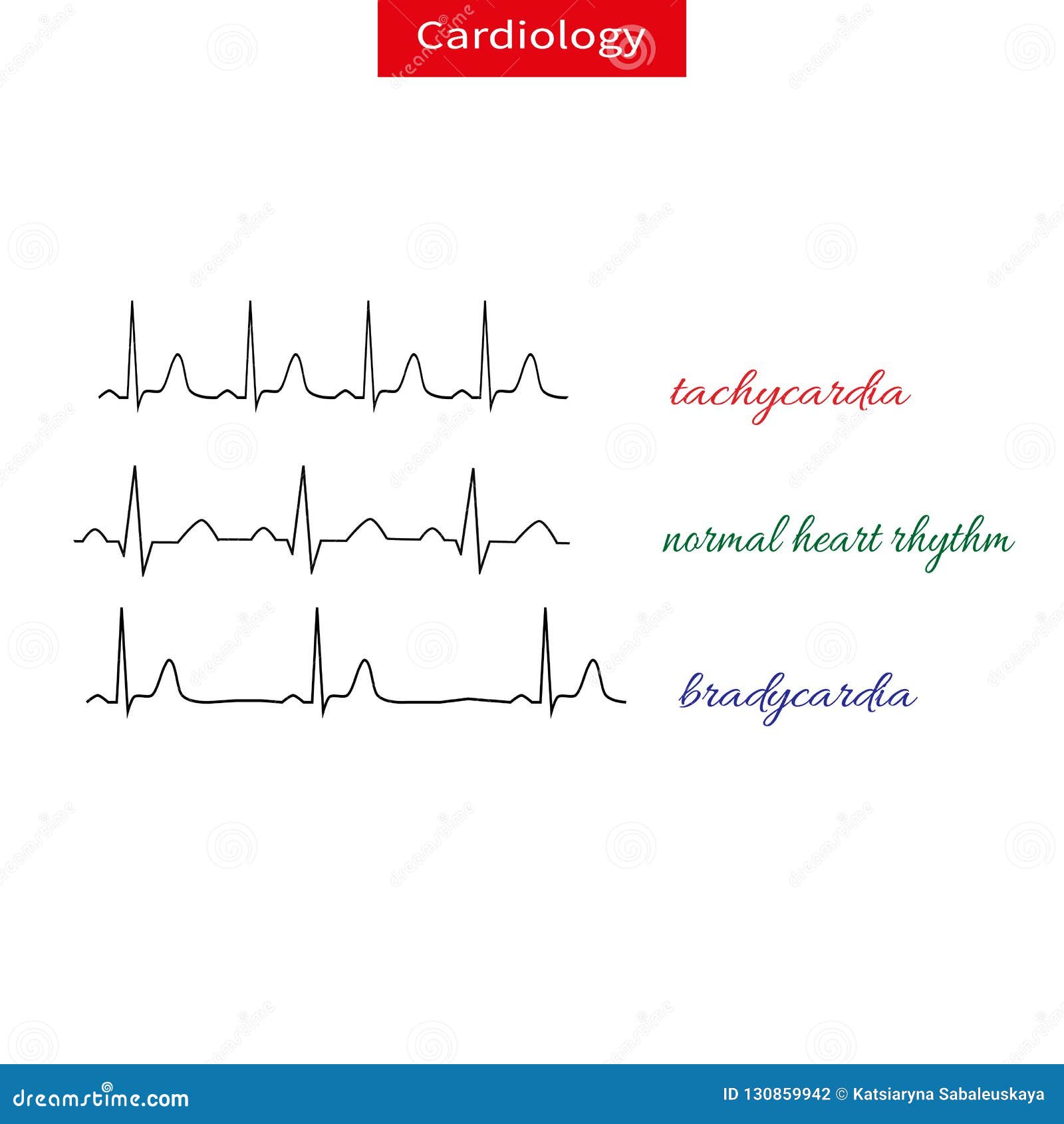 Diagnóstico: Como os Médicos Identificam a Bradicardia? - inspiração 2