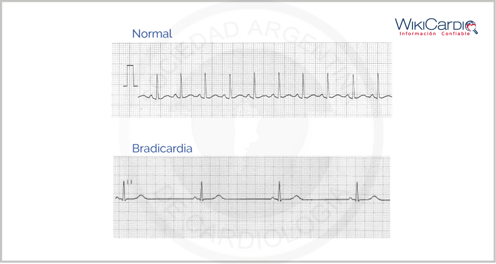 Tratamentos Para Normalizar os Batimentos Cardíacos - inspiração 1