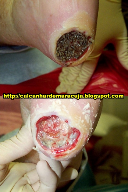 Quando procurar um especialista: sinais de alerta que indicam a necessidade de um dermatologista. - inspiração 2