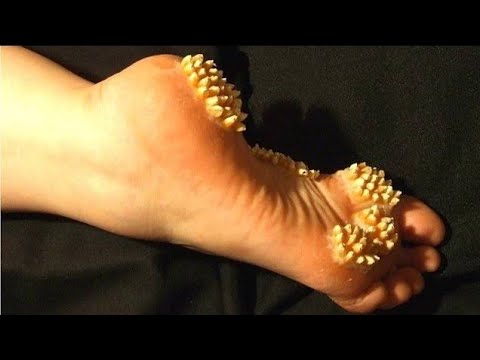 Identificando os primeiros sinais: como saber se seus calcanhares precisam de atenção extra? - inspiração 2