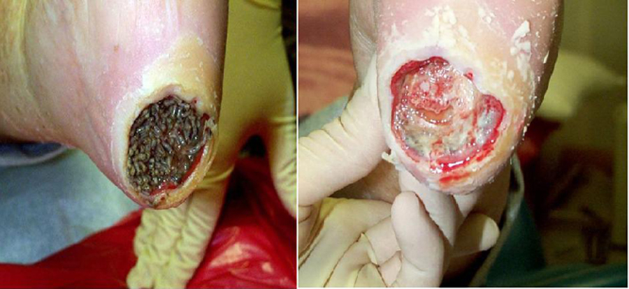 A receita caseira infalível: como usar a polpa do maracujá para um tratamento natural? - inspiração 2