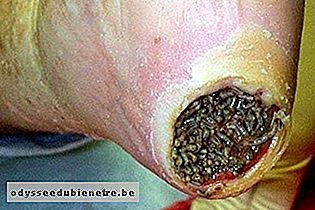 Esfoliação correta: o passo a passo para remover células mortas sem agredir a pele. - inspiração 1