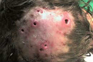 Esfoliação correta: o passo a passo para remover células mortas sem agredir a pele. - inspiração 2