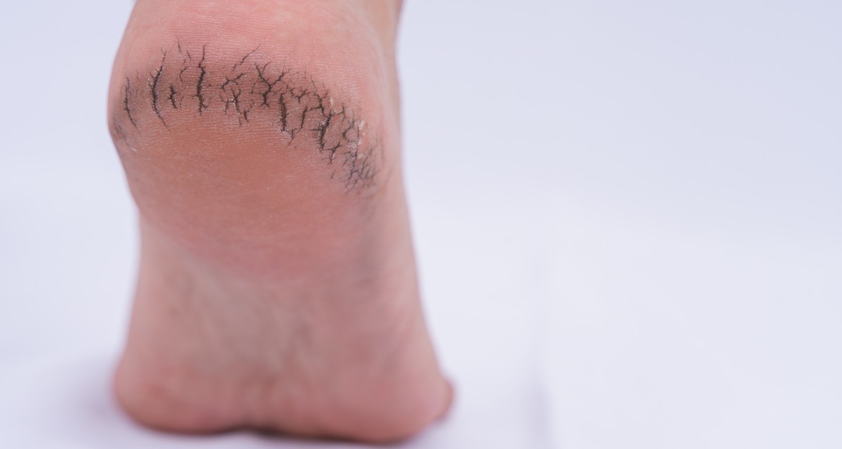 A importância da massagem: técnicas simples para estimular a circulação e o relaxamento. - inspiração 2