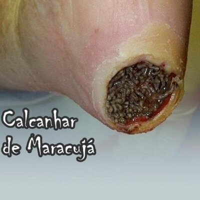 Evitando o ressecamento: hábitos diários para manter seus calcanhares sempre hidratados. - inspiração 1