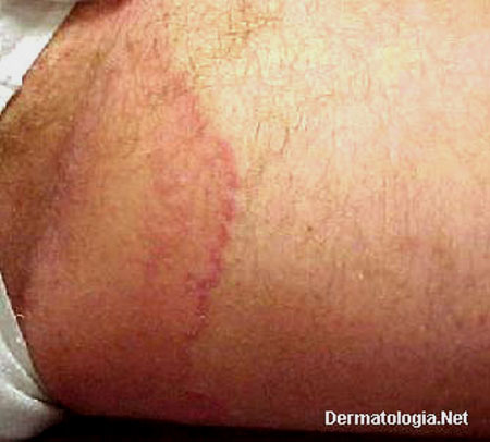 Higiene Íntima: O Que Fazer e o Que Evitar - inspiração 2