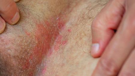 Fatores de Estilo de Vida: Alimentação e Estresse - inspiração 1