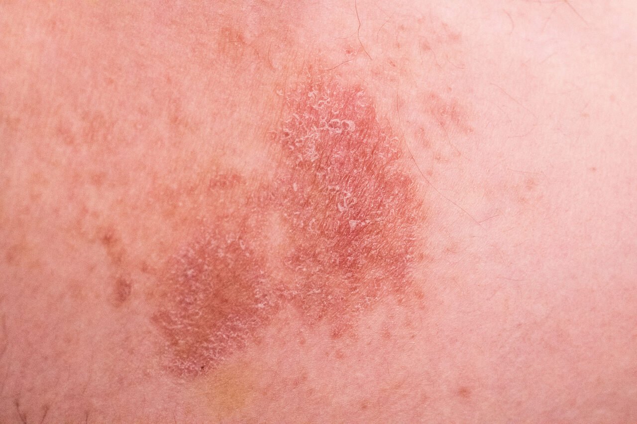 Fatores de Estilo de Vida: Alimentação e Estresse - inspiração 2