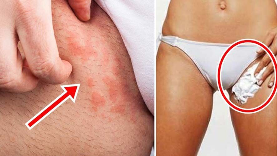 A Relação com a Depilação: Cuidados Pós-Procedimento - inspiração 2