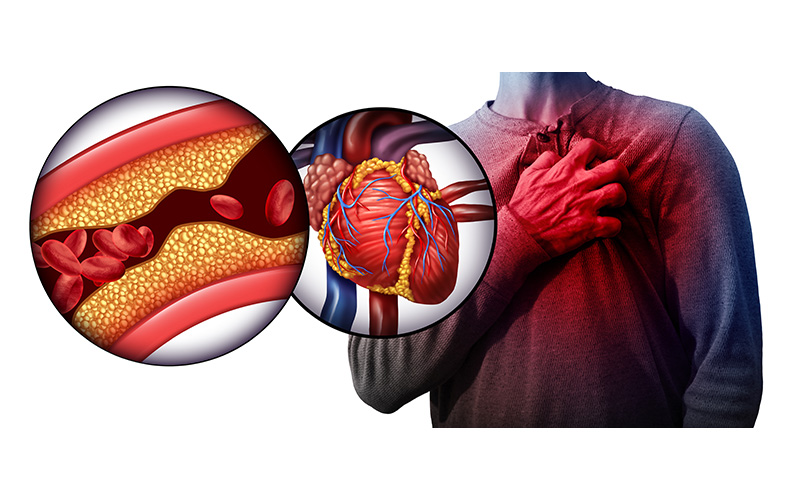 Colesterol Bom (HDL) x Colesterol Ruim (LDL): A Diferença Clara - inspiração 1