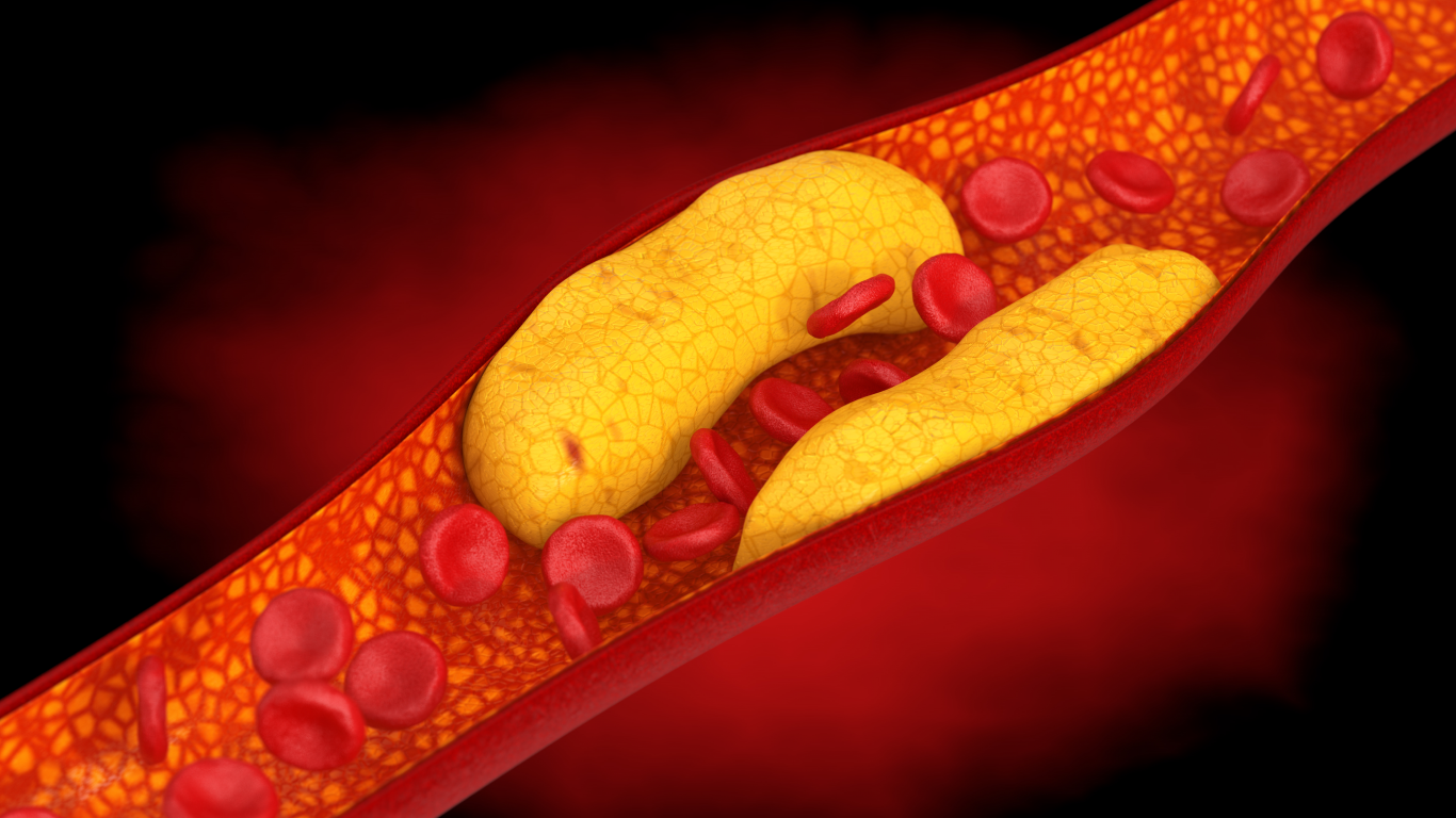 A Importância do Peso Corporal no Controle do Colesterol - inspiração 1