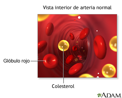 Os Riscos Invisíveis do Colesterol Alto Não Controlado - inspiração 2