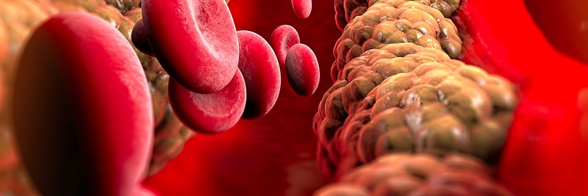 Dicas Para Manter Seus Níveis de Colesterol Sob Controle no Dia a Dia - inspiração 1