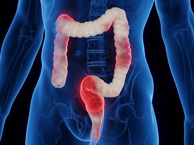 Prevenção de Crises: O Que Está ao Seu Alcance - inspiração 1