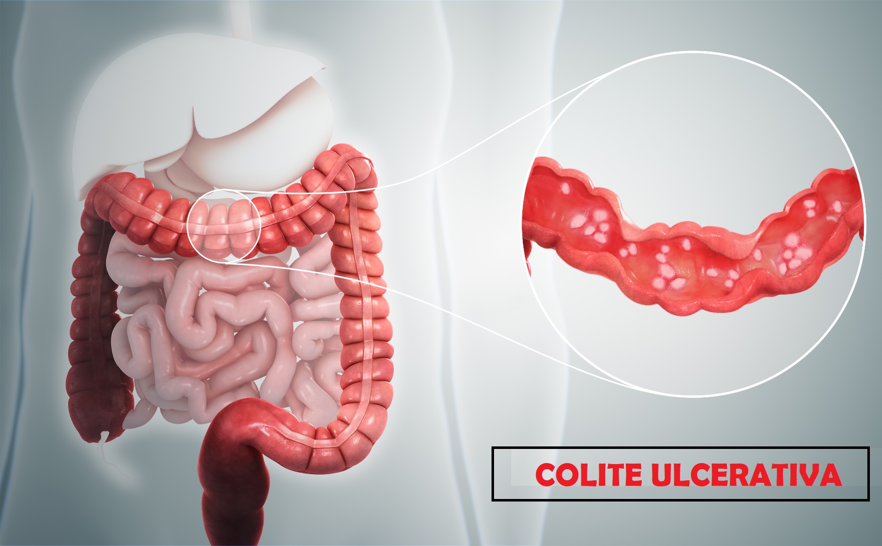 Sintomas que Você Precisa Observar - inspiração 1