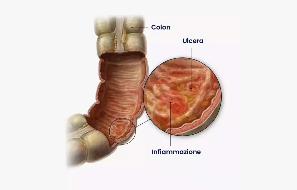 Tratamentos Disponíveis para Aliviar o Desconforto - inspiração 1