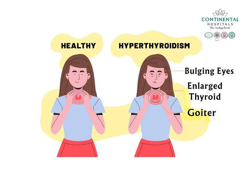 A Conexão Entre Selênio e uma Melhor Captação de Iodo - inspiração 2