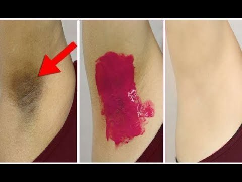 Sol e Axilas: A Relação e Cuidados Necessários para Evitar Escurecimento - inspiração 2