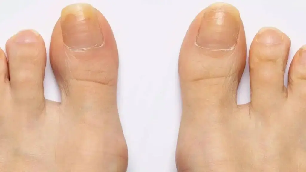 Água Oxigenada: Cuidado e Atenção ao Usar - inspiração 2