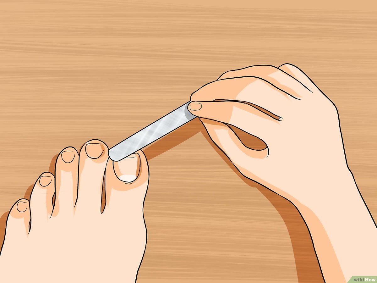 Vinagre de Maçã: Ação Antifúngica e Clareadora - inspiração 2