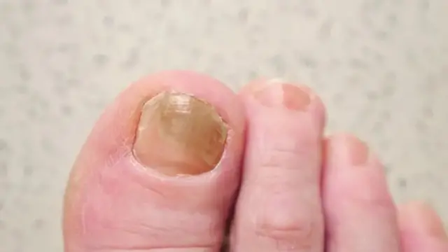 Dicas de Prevenção: Evitando que o Amarelamento Retorne - inspiração 2