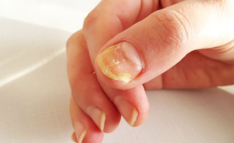 A Importância da Hidratação para a Saúde das Unhas - inspiração 1