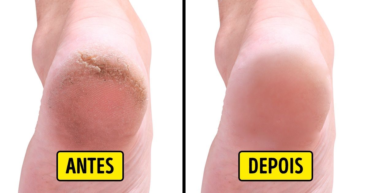 Prevenção é a chave: como evitar o amarelamento futuro - inspiração 2