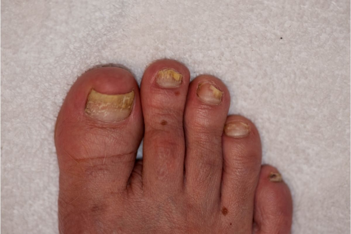 A Alimentação Certa Faz Toda a Diferença para Unhas Saudáveis - inspiração 2