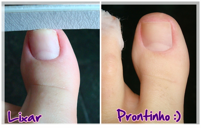 O Que Evitar: Armadilhas Comuns que Podem Piorar o Amarelamento - inspiração 1