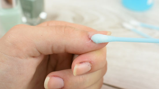 Óleos Essenciais: Aliados Sutis para Unhas Mais Claras - inspiração 1