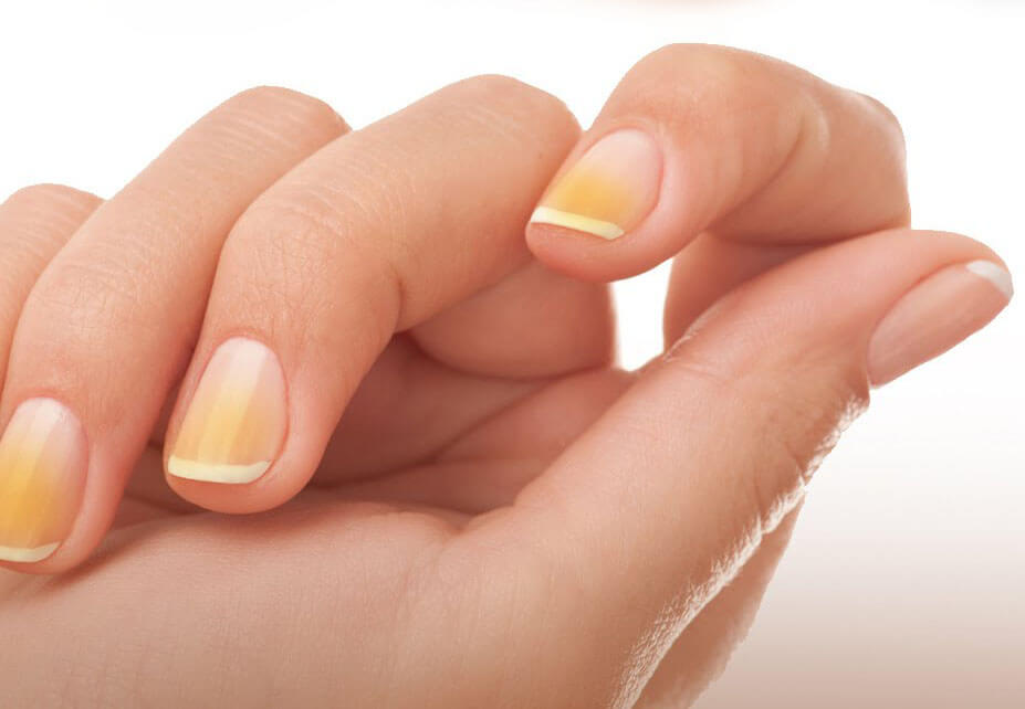 Tratamentos Profissionais: Opções que Valem o Investimento - inspiração 2