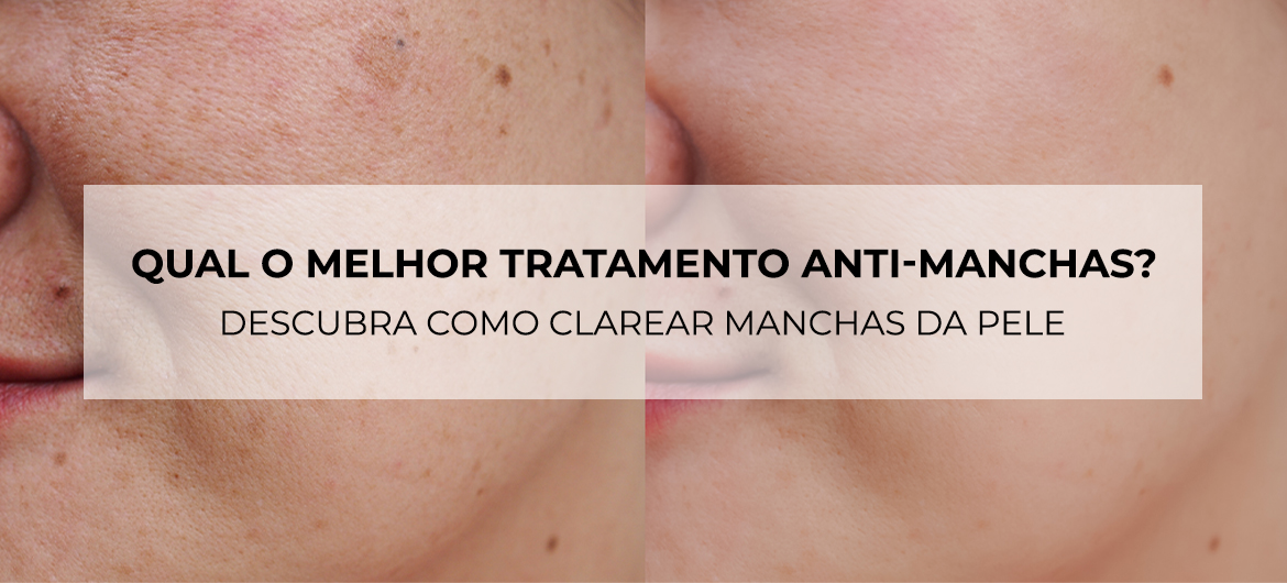 Ingredientes Mágicos: Ativos Poderosos Contra as Manchas - inspiração 2