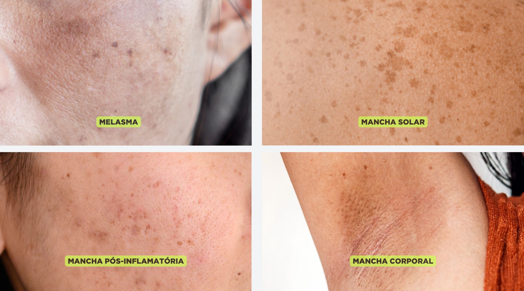 Tratamentos Caseiros: Receitas Naturais Comprovadas - inspiração 2