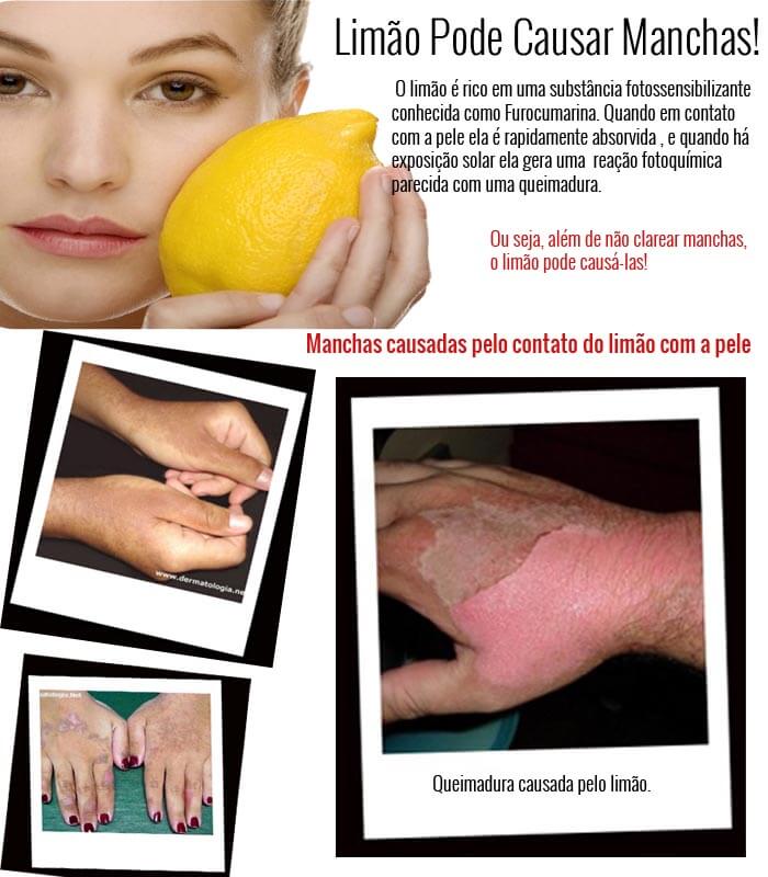 Peelings Químicos e Microdermabrasão: Para Que Servem? - inspiração 2