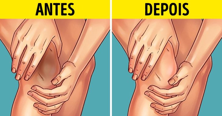 Ingredientes Naturais Que Iluminam Sua Pele - inspiração 2