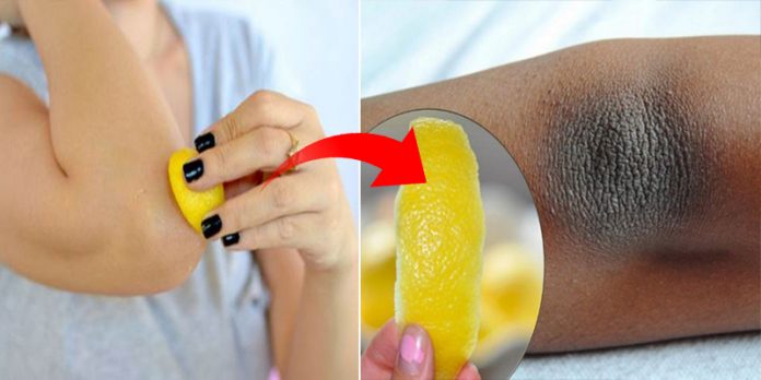 Evitando a Hiperpigmentação: Cuidados Diários Essenciais - inspiração 1