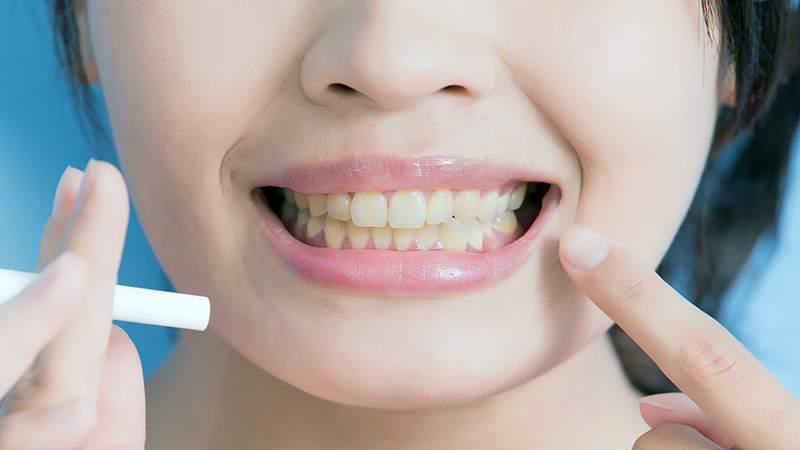 Higiene Bucal: O Pilar Fundamental - inspiração 2