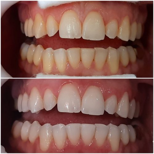 Remédios Caseiros: Mitos e Verdades - inspiração 2