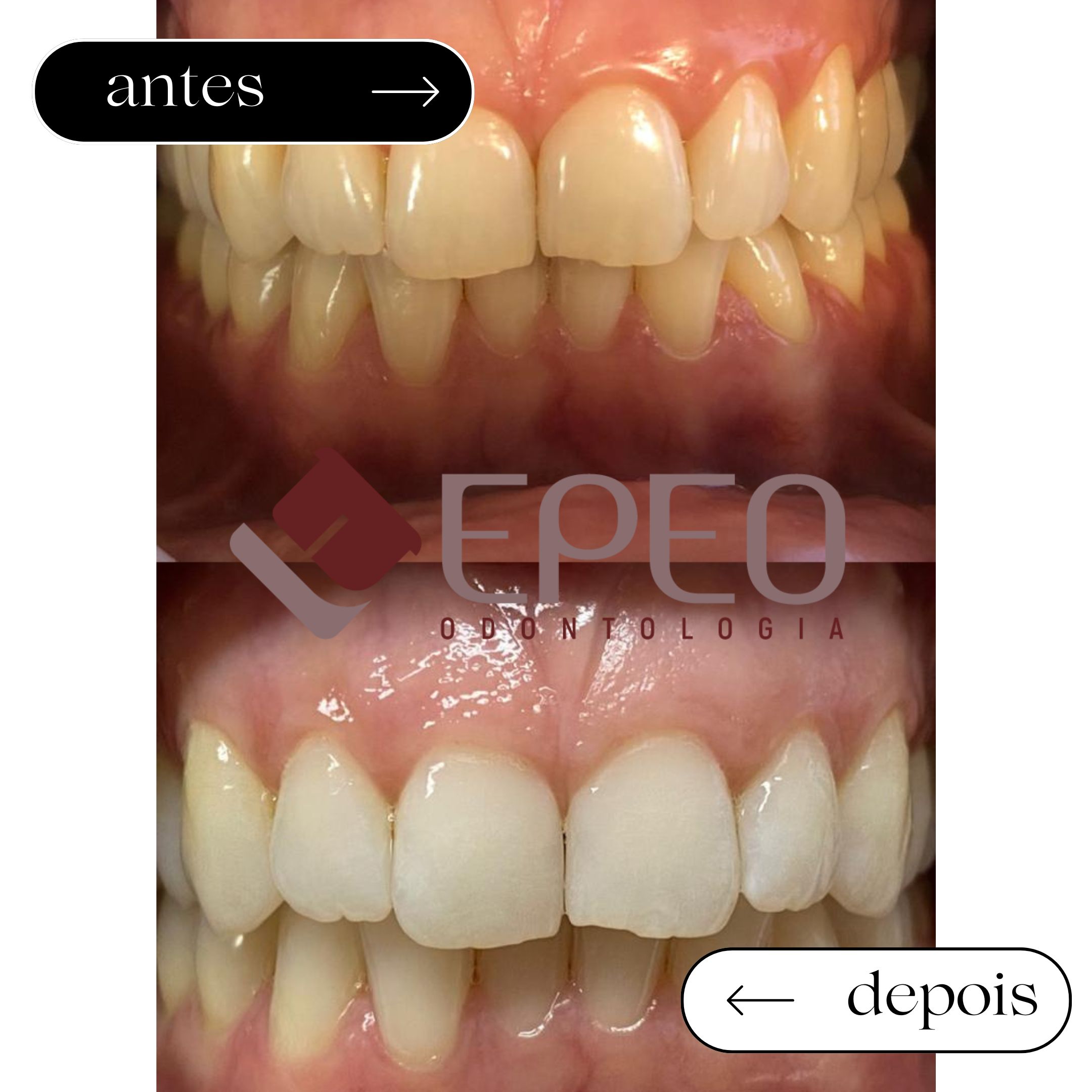 Bicarbonato de Sódio: Um Aliado ou Vilão? - inspiração 2