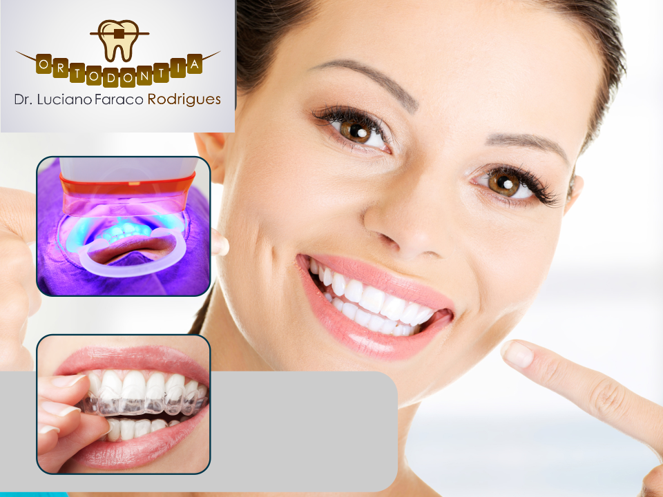 Como Manter o Sorriso Claro Mesmo Após a Retirada do Aparelho - inspiração 1