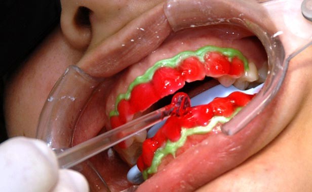 Alimentos e Bebidas Aliados (e Inimigos) do Clareamento - inspiração 2