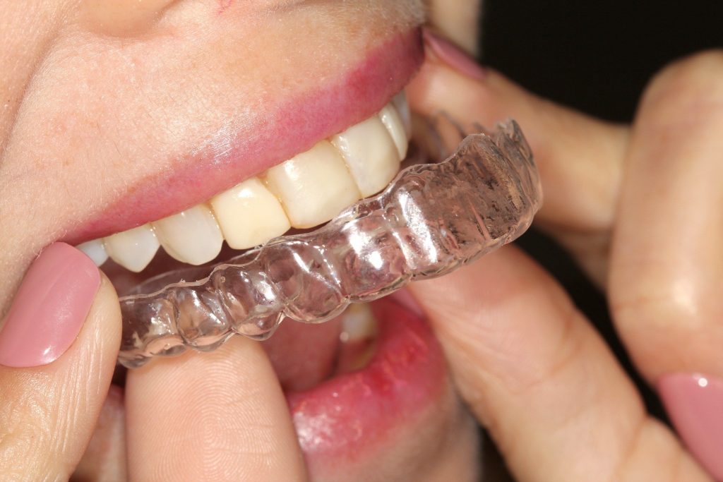 Cuidados Essenciais Após Cada Refeição para Evitar Manchas - inspiração 2